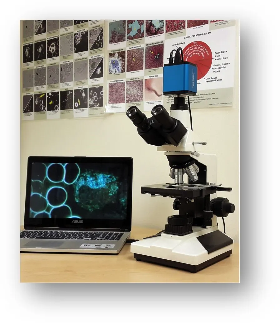 Live blood analysis under dark-field microscopy
